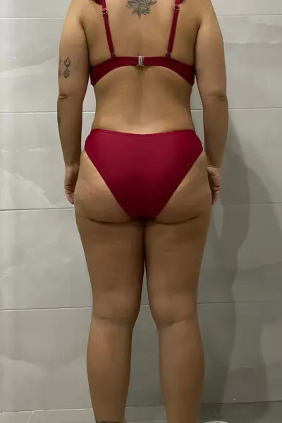 DEPOIS